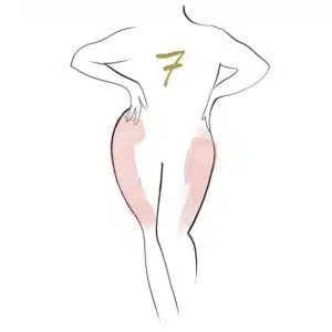 CELLULITE