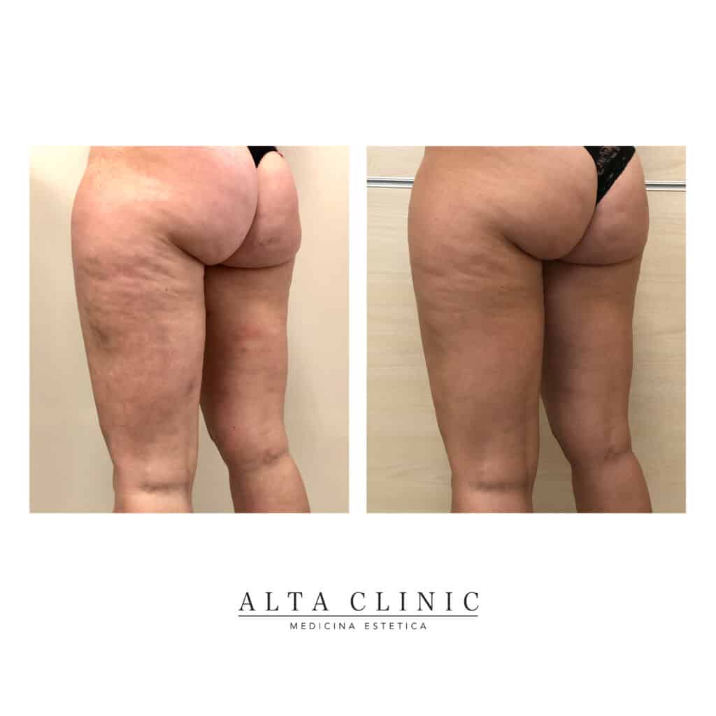 : lipo-mino-mix-c ndc:73198015630 suggest hcp[c code Lipo-Mino Mix Product Info