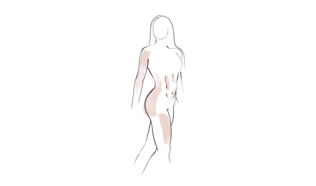 Emsculpt Neo