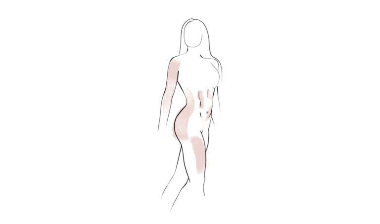 Illustrazione di un corpo femminile con addome e fianchi evidenziati per il trattamento Emsculpt Neo ad Alta Clinic Bergamo