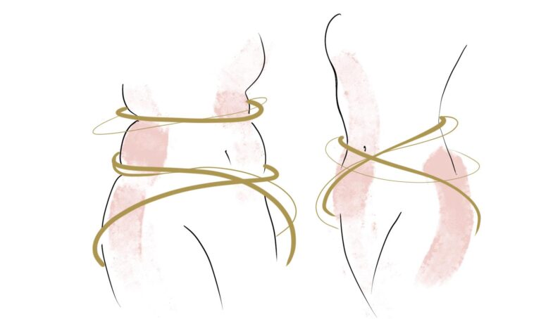 Silhouette femminili con fili dorati intorno a vita e fianchi, percorso di dimagrimento guidato ad Alta Clinic Bergamo